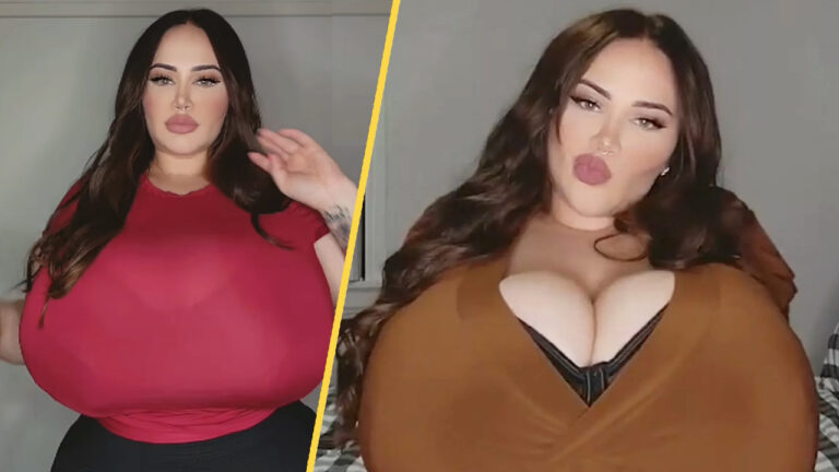 Australian Woman’s Struggle with Rare Breast Condition Reshapes Her Life